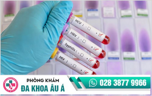 Trung tâm xét nghiệm bệnh hoa liễu uy tín tại TP.HCM　　　　