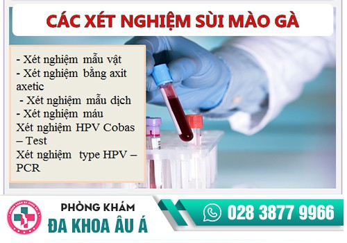 Những phương pháp xét nghiệm sùi mào gà hiện nay là gì?