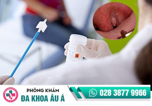 xét nghiệm các bệnh xã hội