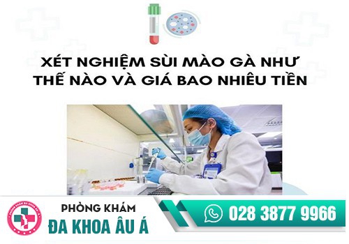 Giá xét nghiệm sùi mào gà