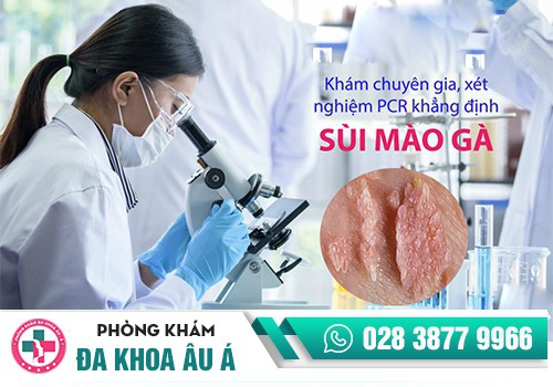Giá xét nghiệm sùi mào gà