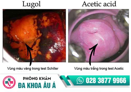 Xét nghiệm bệnh xã hội