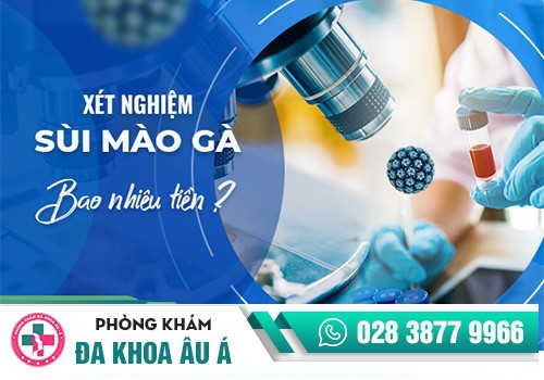 Chi phí xét nghiệm sùi mào gà là bao nhiêu?