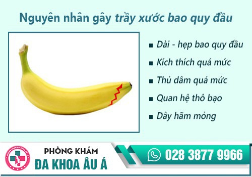 TRẦY XƯỚC BAO QUY ĐẦU