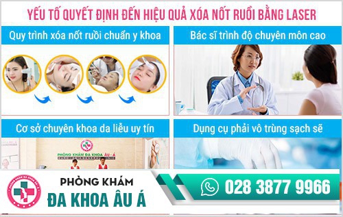 xóa nốt ruồi bằng laser