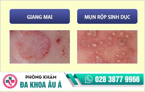 Bệnh dương vật