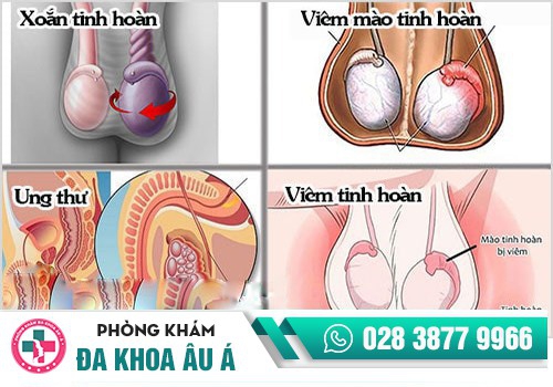 Bệnh tinh hoàn bao gồm những bệnh lý nào?