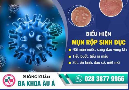 mụn sinh dục