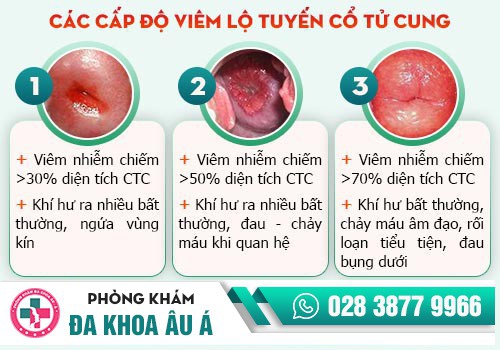 KHÍ HƯ RA NHIỀU