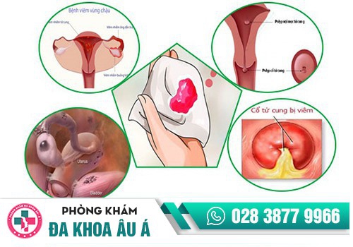 MÁU ÂM ĐẠO