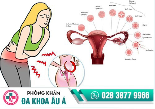 Đau bụng dưới bên phải ở nữ là dấu hiệu của bệnh gì?