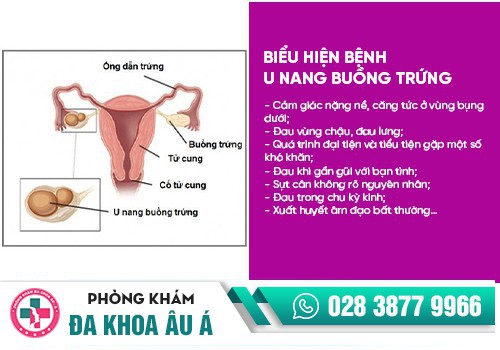 Đau bụng dưới bên phải ở nữ là dấu hiệu của bệnh gì?