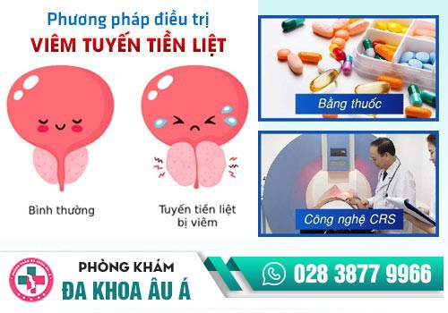 ĐIỀU TRỊ VIÊM TUYẾN TIỀN LIỆT