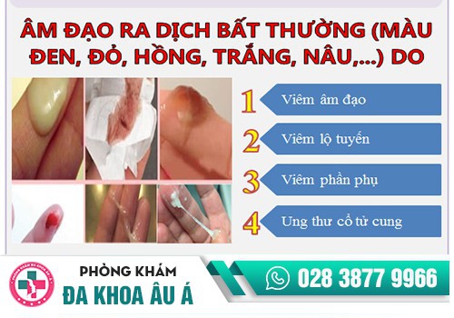 Huyết trắng màu nâu là bị gì?