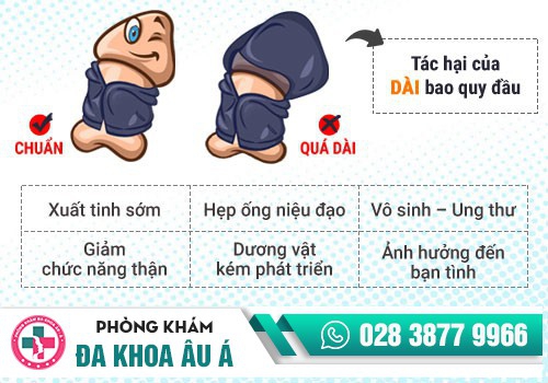 DÀI BAO QUY ĐẦU LÀ NHƯ THẾ NÀO?