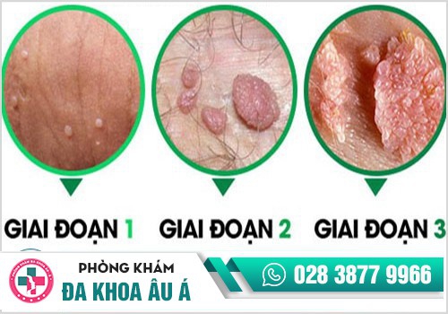 Bệnh xã hội 