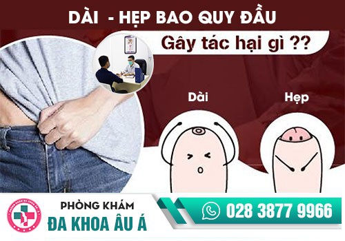Hình ảnh hẹp bao quy đầu ở người lớn