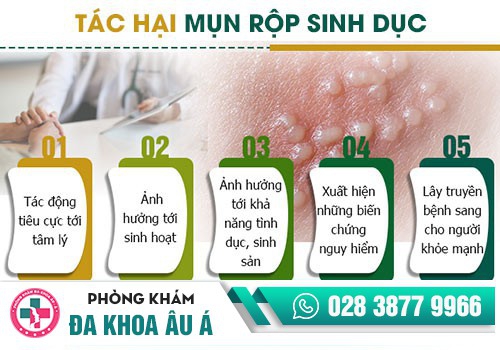 trị mụn rộp sinh dục tại nhà