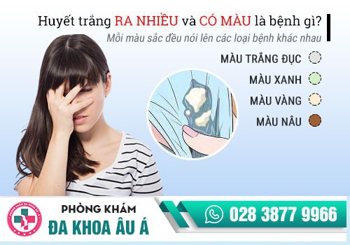 Những dấu hiệu huyết trắng bất thường cần lưu ý