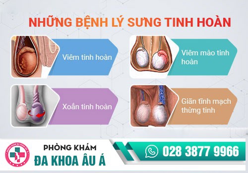 Sưng tinh hoàn 