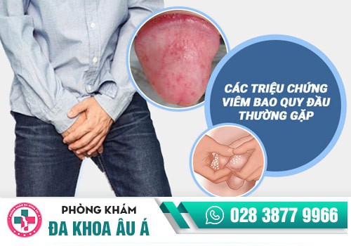 Viêm bao quy đầu gây lở loét bao quy đầu