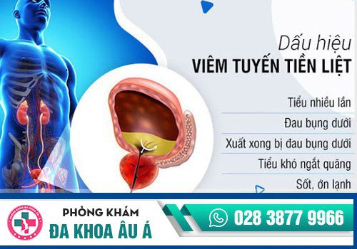 Viêm tuyến tiền liệt 